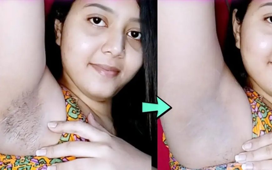 বগলের লোম ও কালো দাগ তুলে বগল পরিস্কার করার দুর্দান্ত উপায়